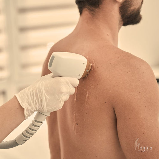 DEPILACION ESPALDA HOMBRE