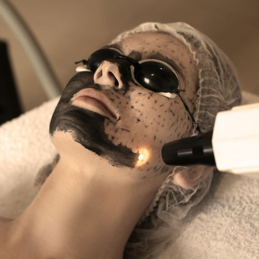 HOLLYWOOD PEEL - CARBON PEEL